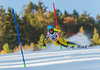 Erin Mielzynski of Canada during 1st run of ladies Slalom of the Lienz FIS Ski Alpine World Cup at the Hochstein in Lienz, Austria on 2015/12/29.
